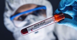 Azərbaycanda daha 61 nəfərdə koronavirus aşkarlandı